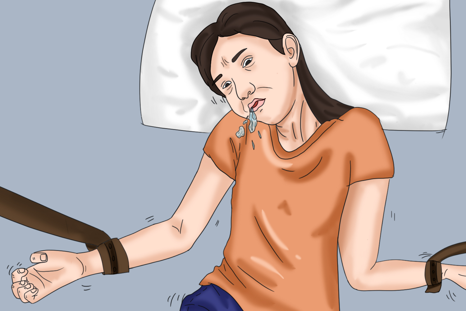 兴奋期发作图 兴奋期发作图