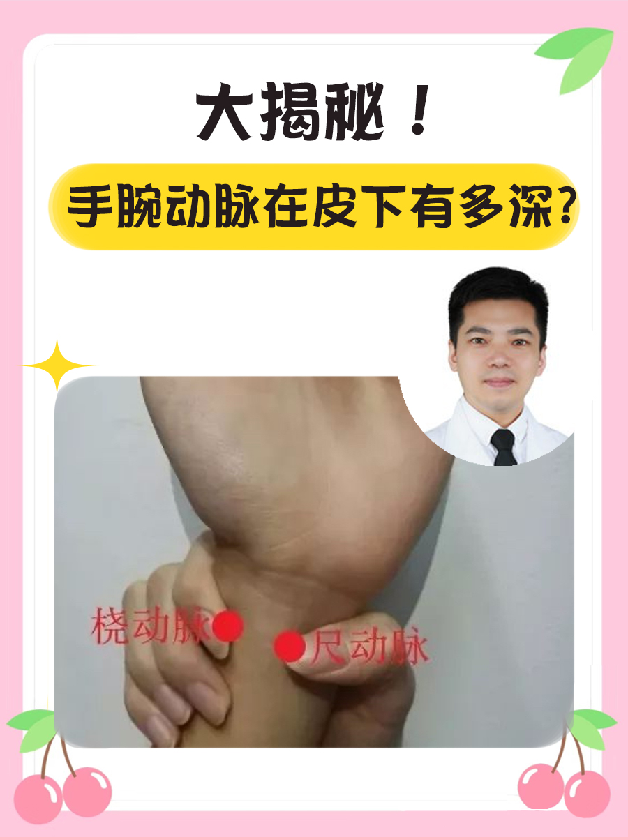 大揭秘！手腕动脉在皮下有多深？