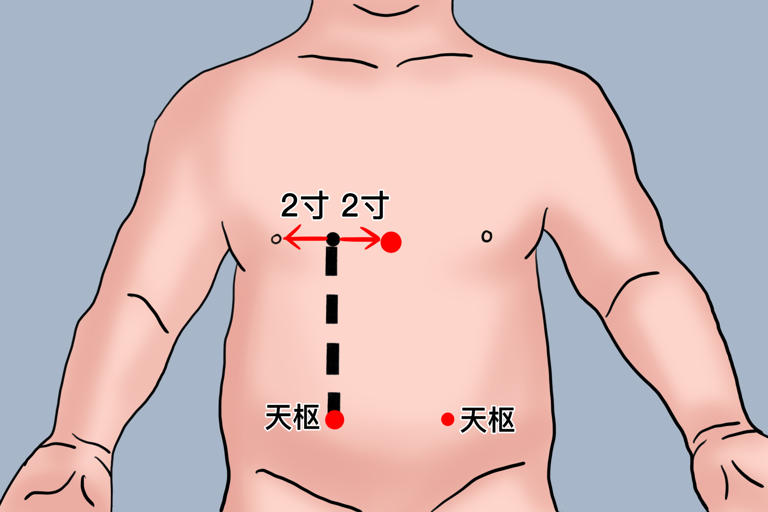 天枢小儿便秘可以通过推拿天枢,中脘,足三里等穴位进行改善,具体手法