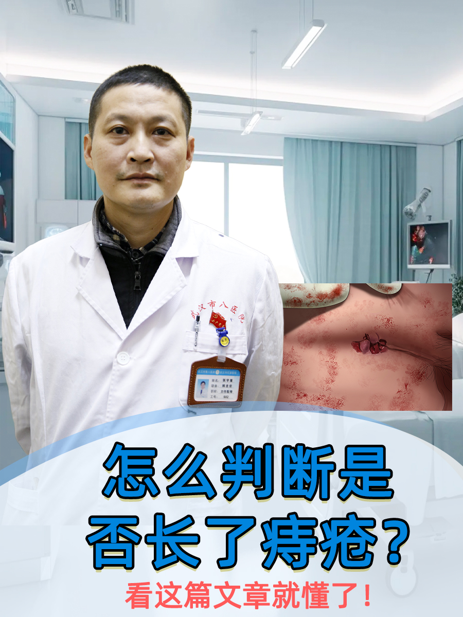 怎么判断是否长了痔疮？看这篇文章就懂了！