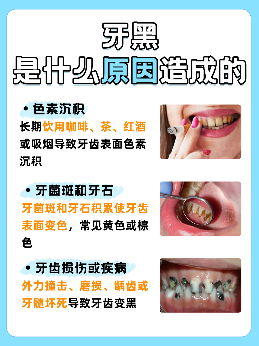 牙齿变黑？揭秘背后的真正原因！