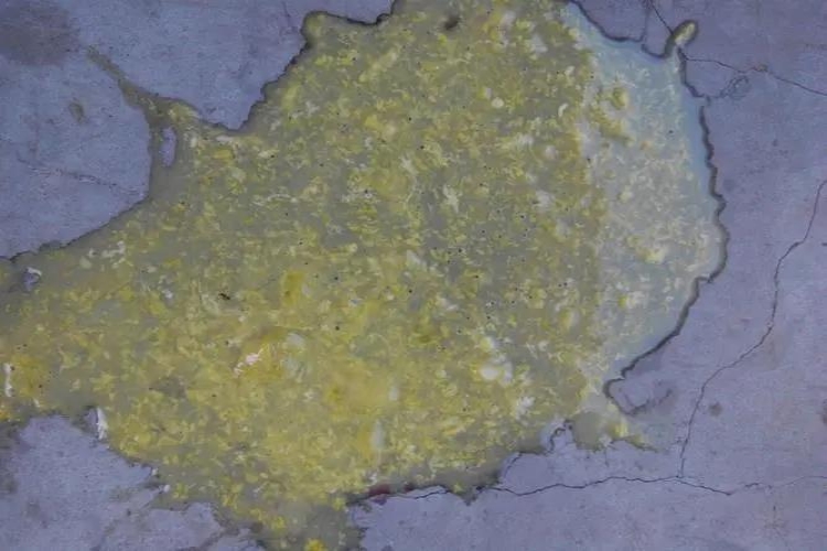 消化不良棉絮状大便图