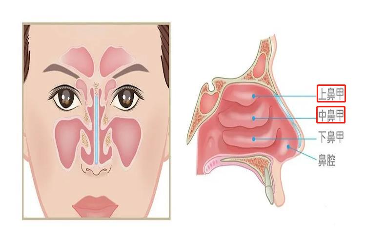 上鼻甲和中鼻甲图