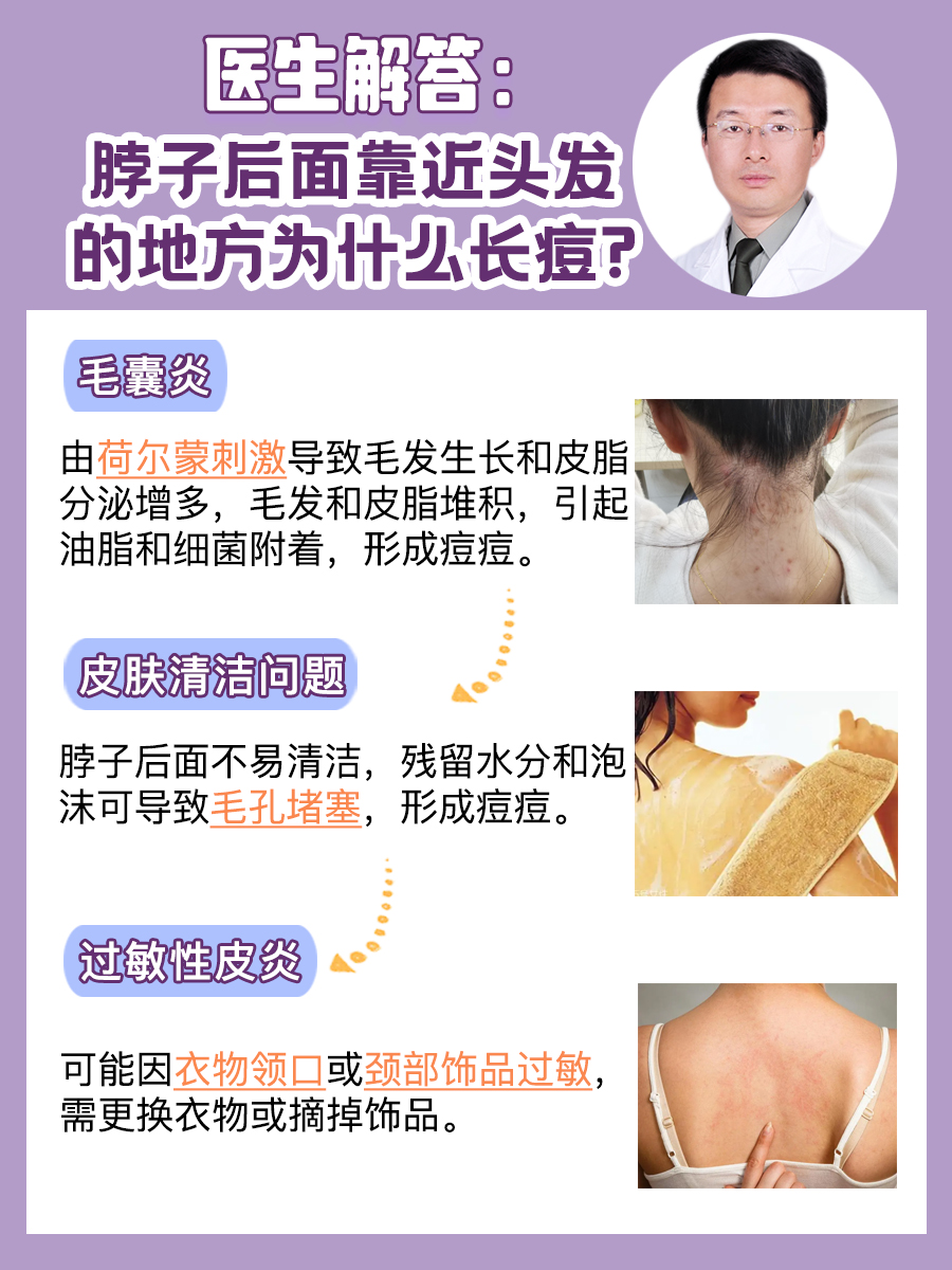 医生解答：脖子后面靠近头发的地方为什么长痘?