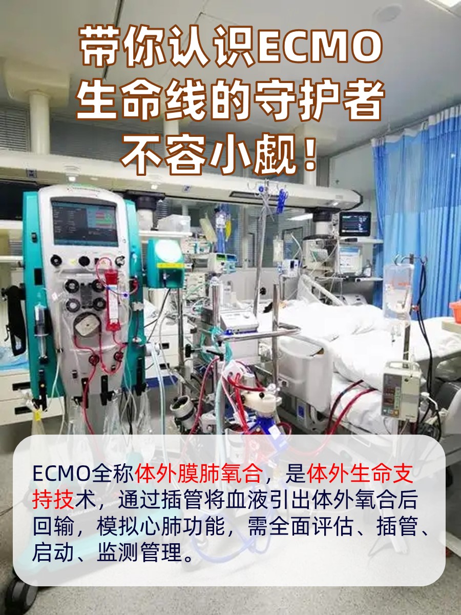 带你认识ECMO：生命线的守护者，不容小觑！