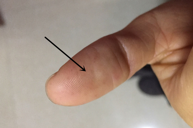 正常指腹外观图