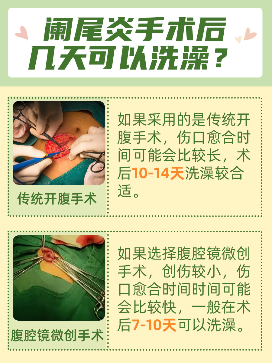 揭秘阑尾炎手术后，多久才是安全洗澡的最佳时机？