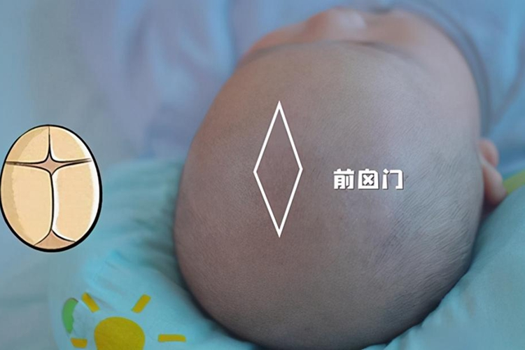 前囟门微微凹陷图 前囟门微微凹陷图