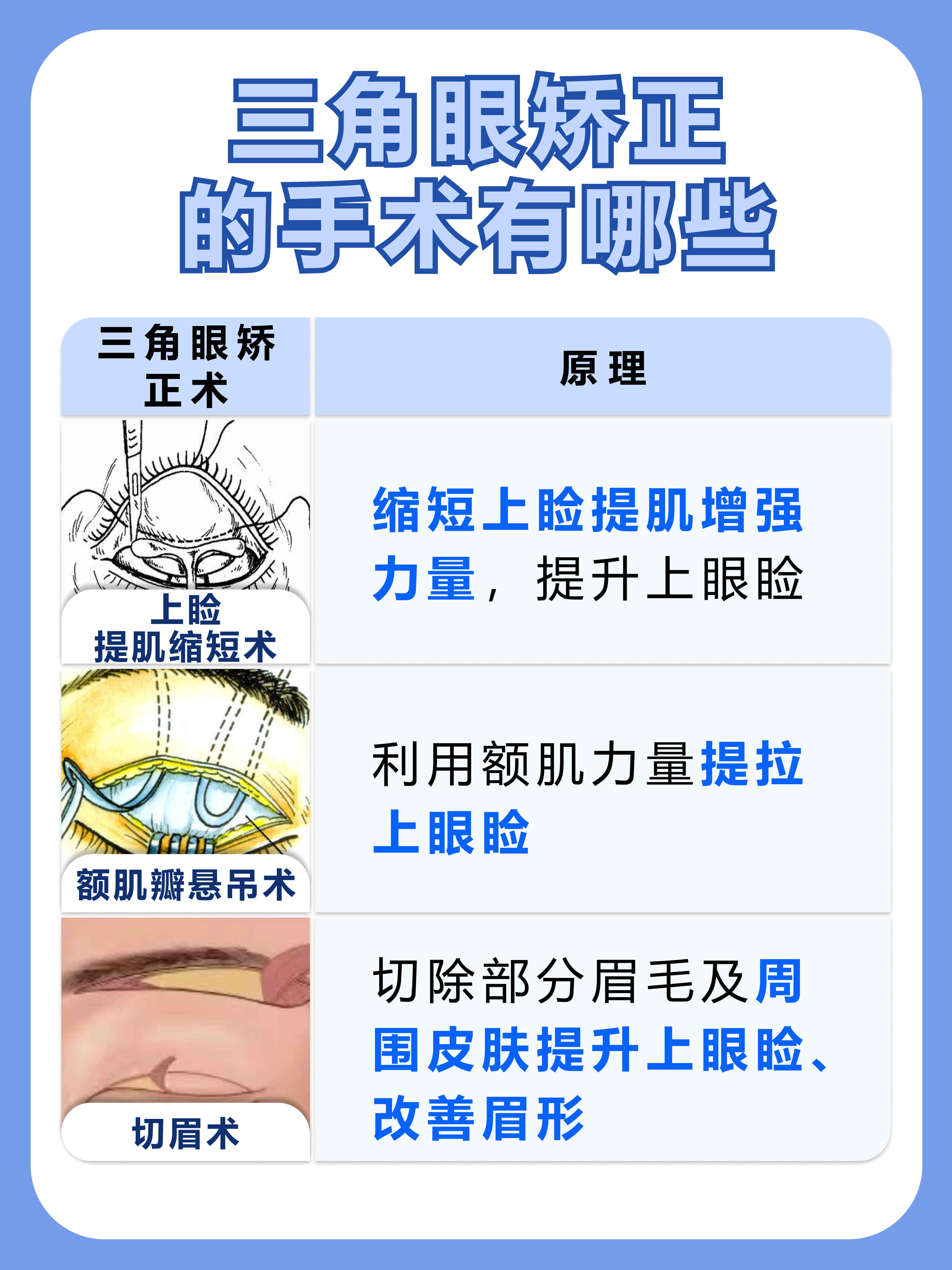 三角眼是什么样子图片