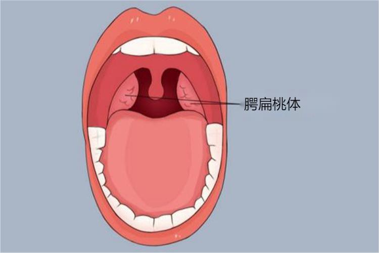 舌腭弓和咽腭弓图片