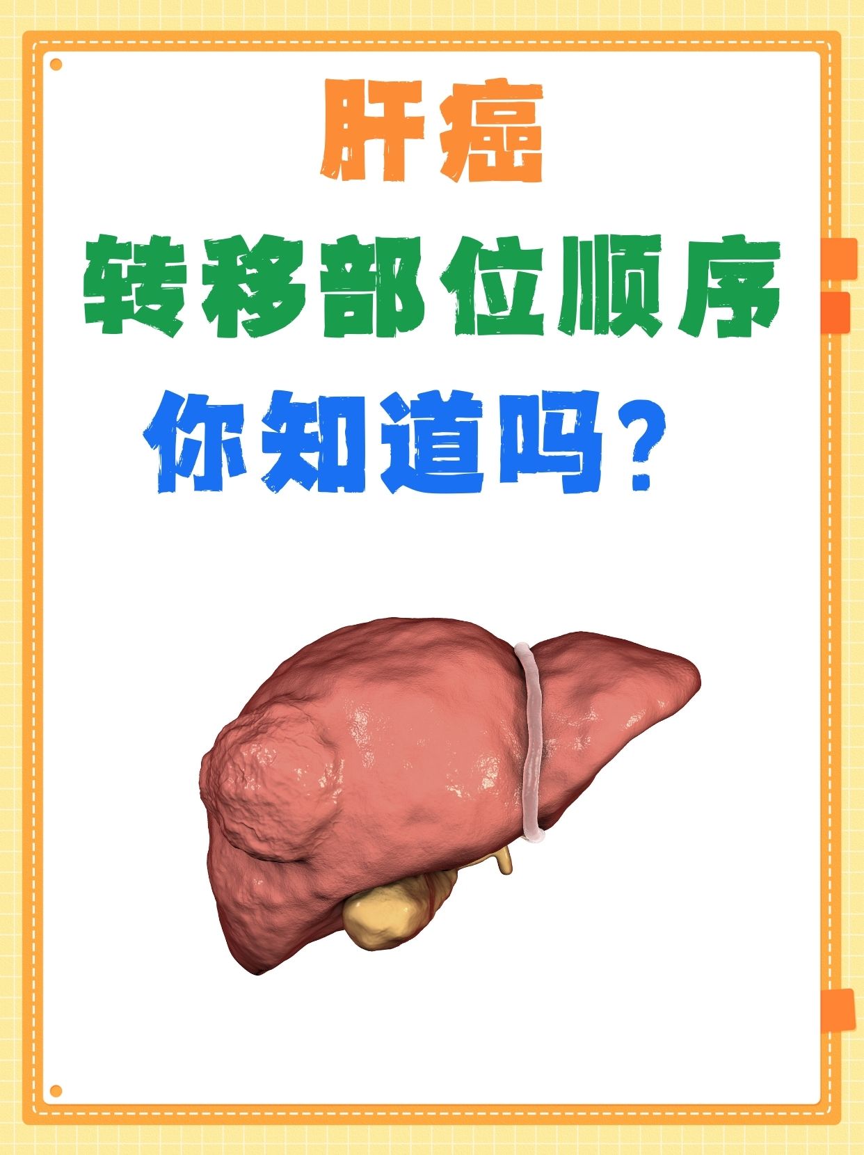 肝癌转移部位顺序，你知道吗？