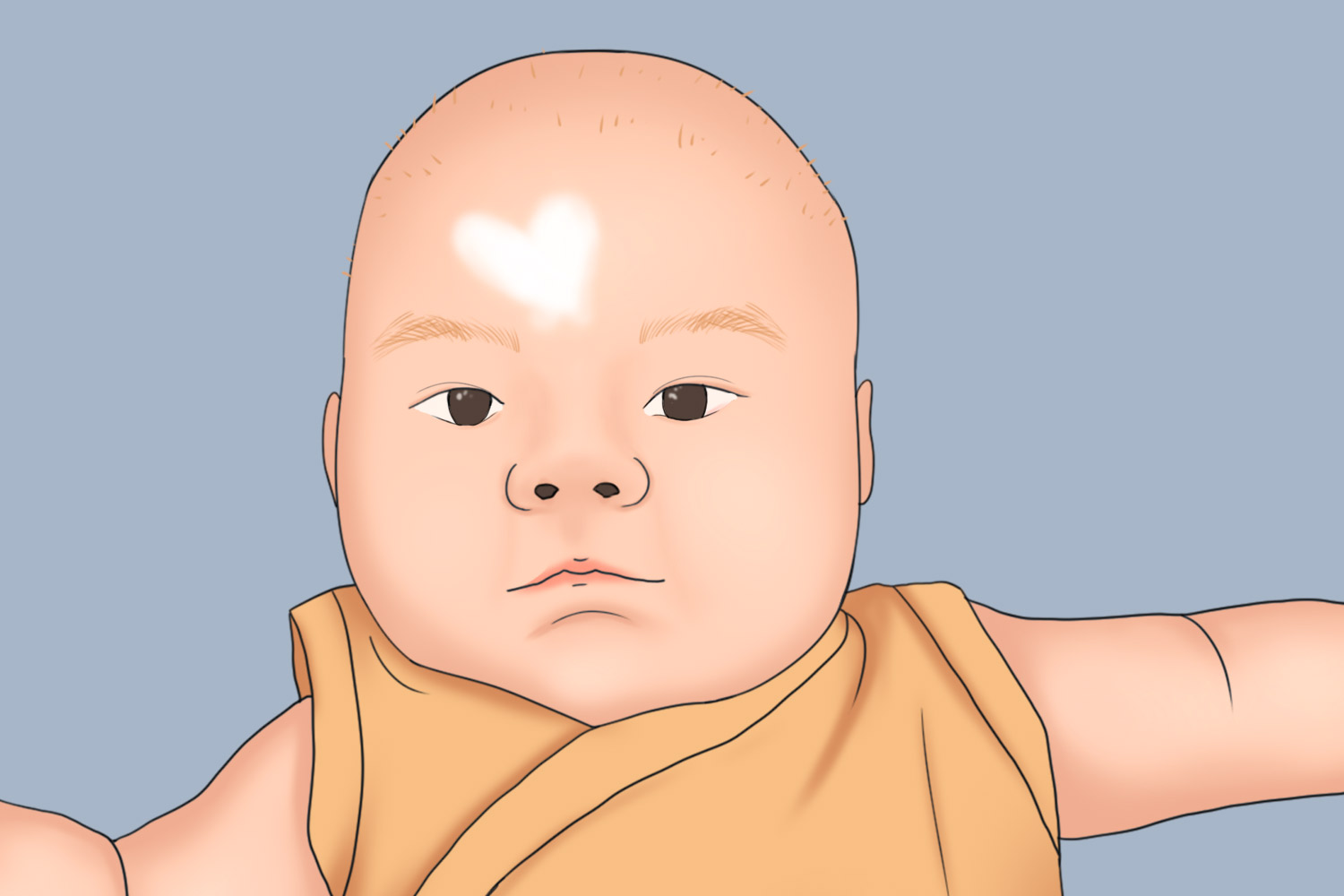 婴儿额头白色胎记图 婴儿额头白色胎记图