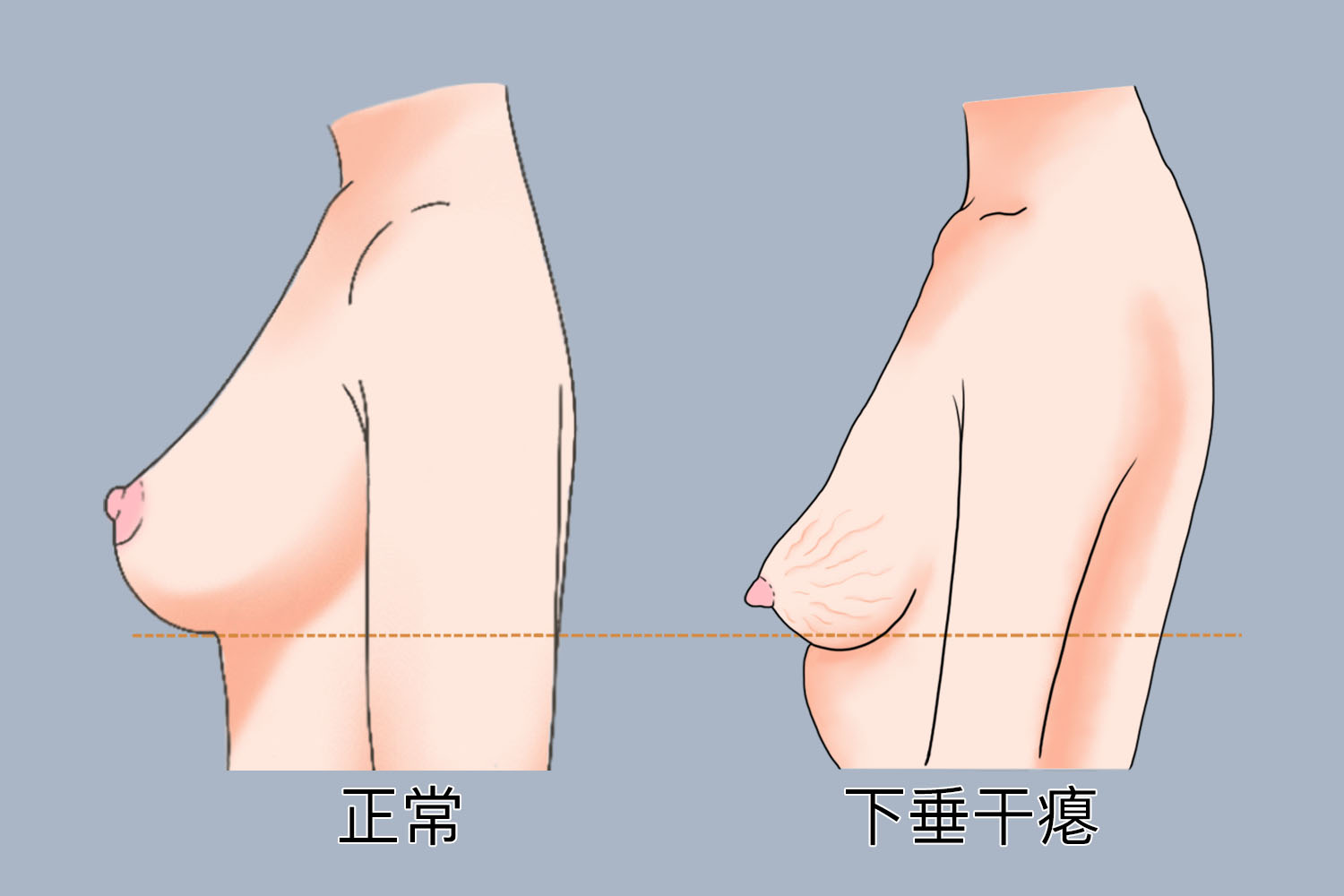 断奶后胸就剩一张皮图