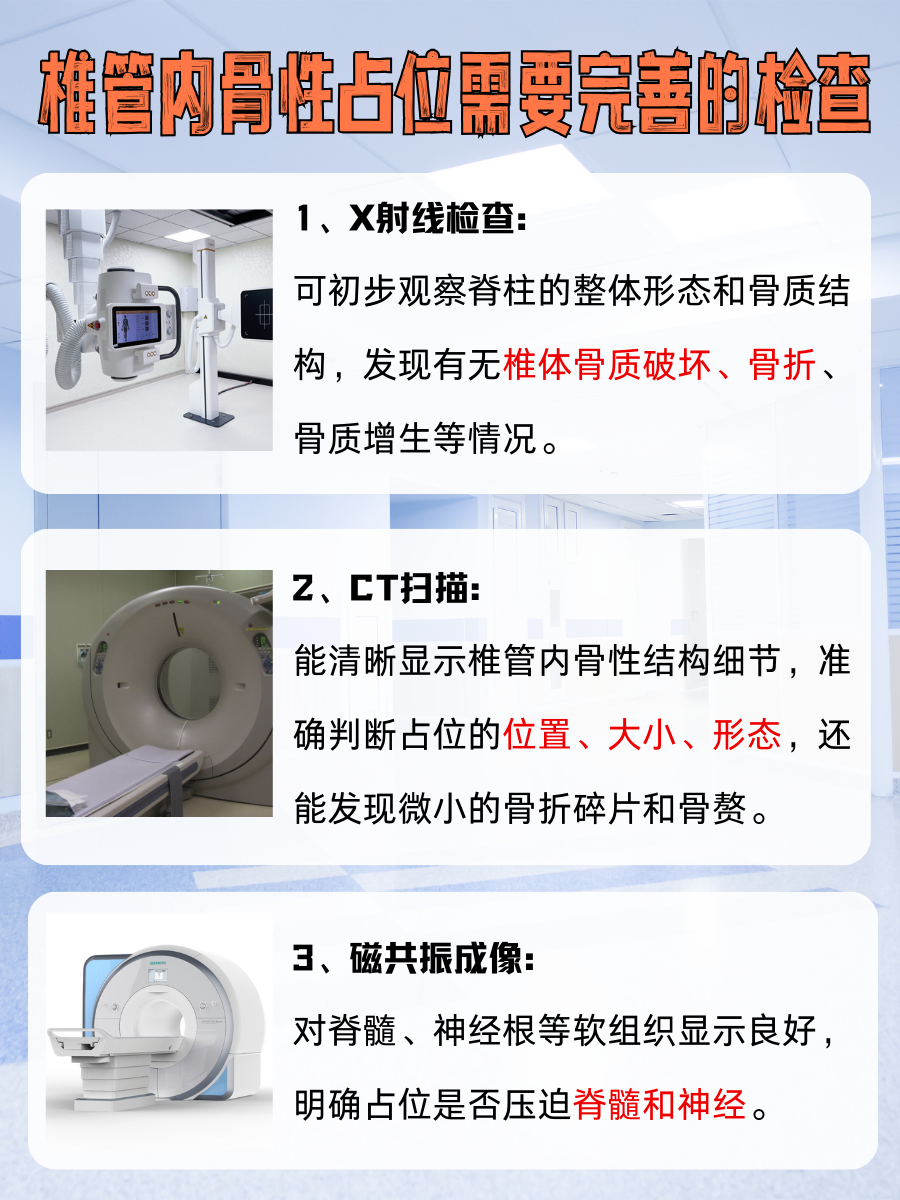 别忽视！椎管内骨性占位是什么意思？不可小看