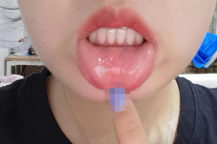 正常人的嘴唇内部图