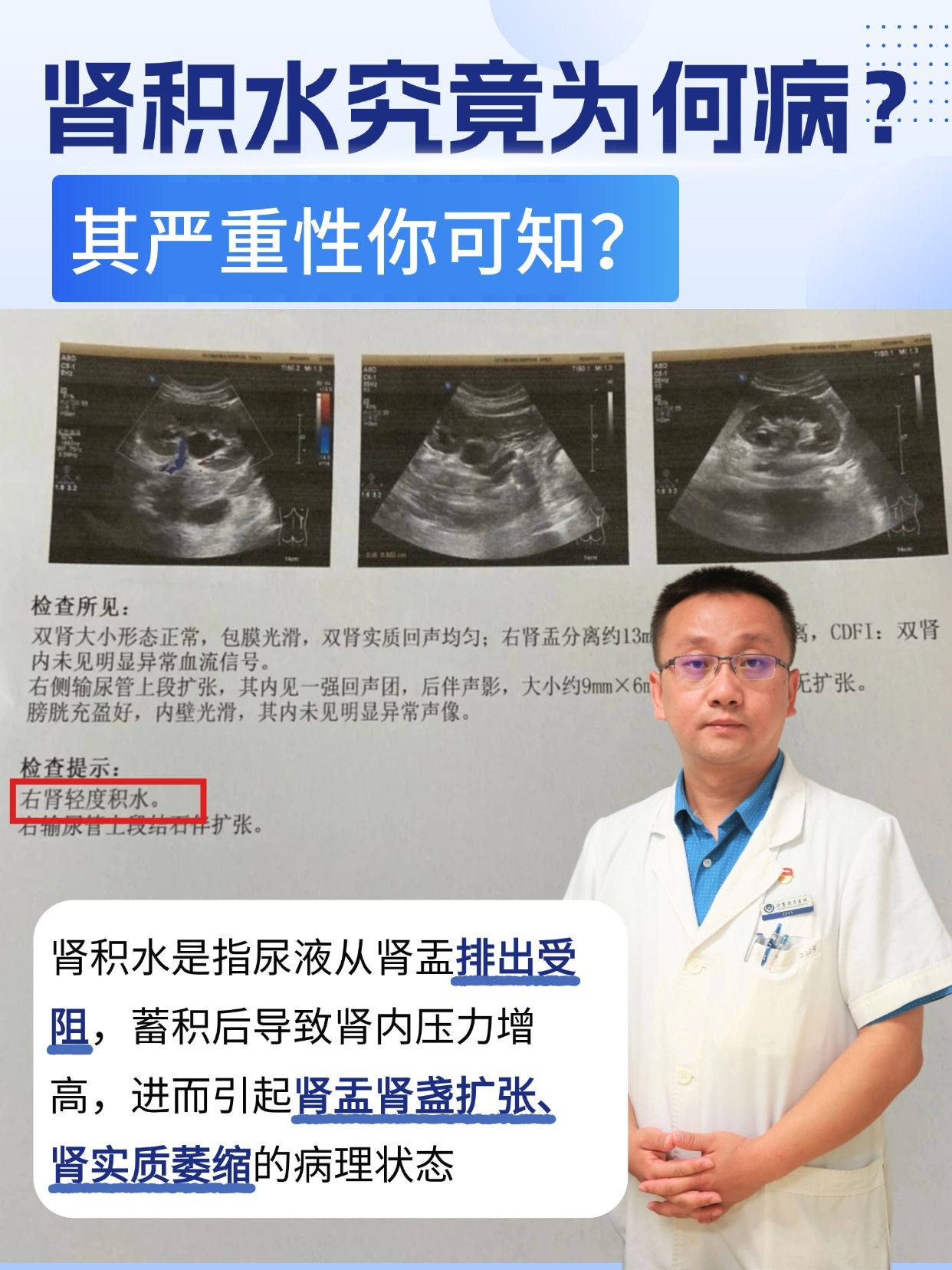 肾积水究竟为何病？其严重性你可知？