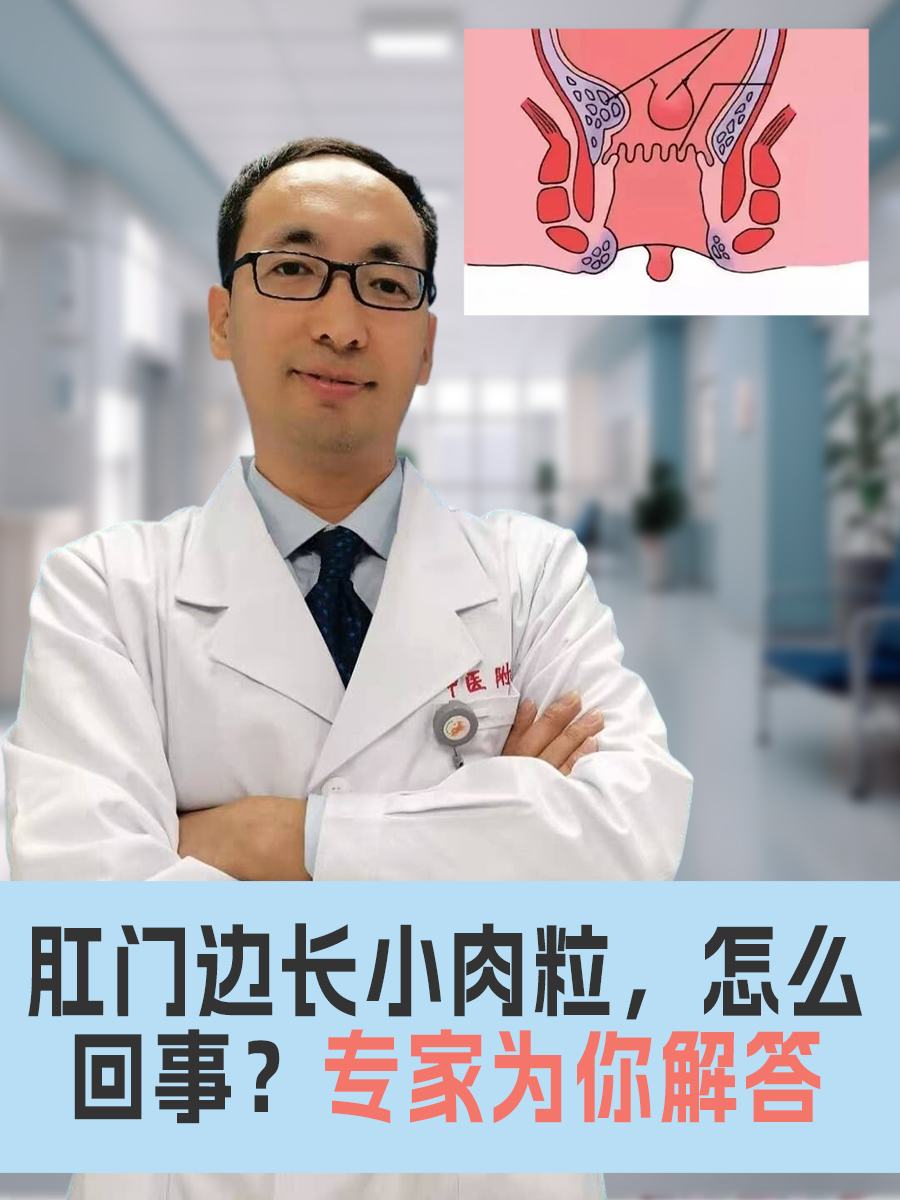 肛门边长小肉粒,怎么回事?专家为你解答