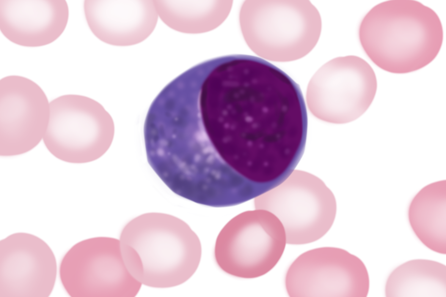 Ⅰ型异型淋巴细胞图