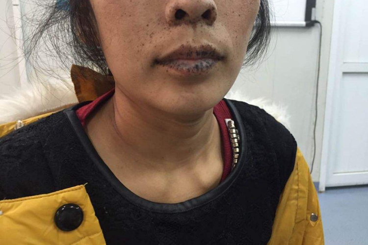 嘴唇黑是哪里有问题