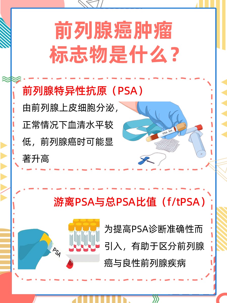 前列腺癌肿瘤标志物，你了解多少？
