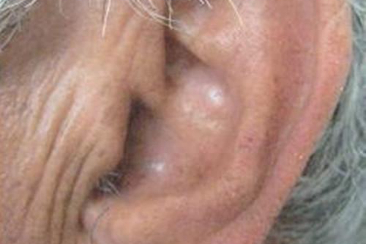 耳朵靠近脸一侧有竖纹图 耳朵靠近脸一侧有竖纹图