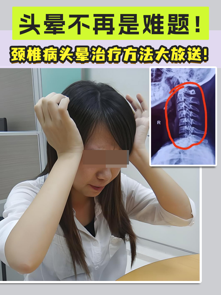 头晕不再是难题！颈椎病头晕治疗方法大放送！
