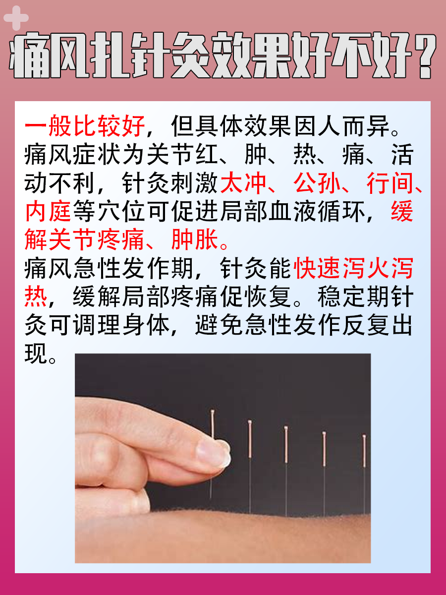 痛风扎针灸,效果究竟好不好?