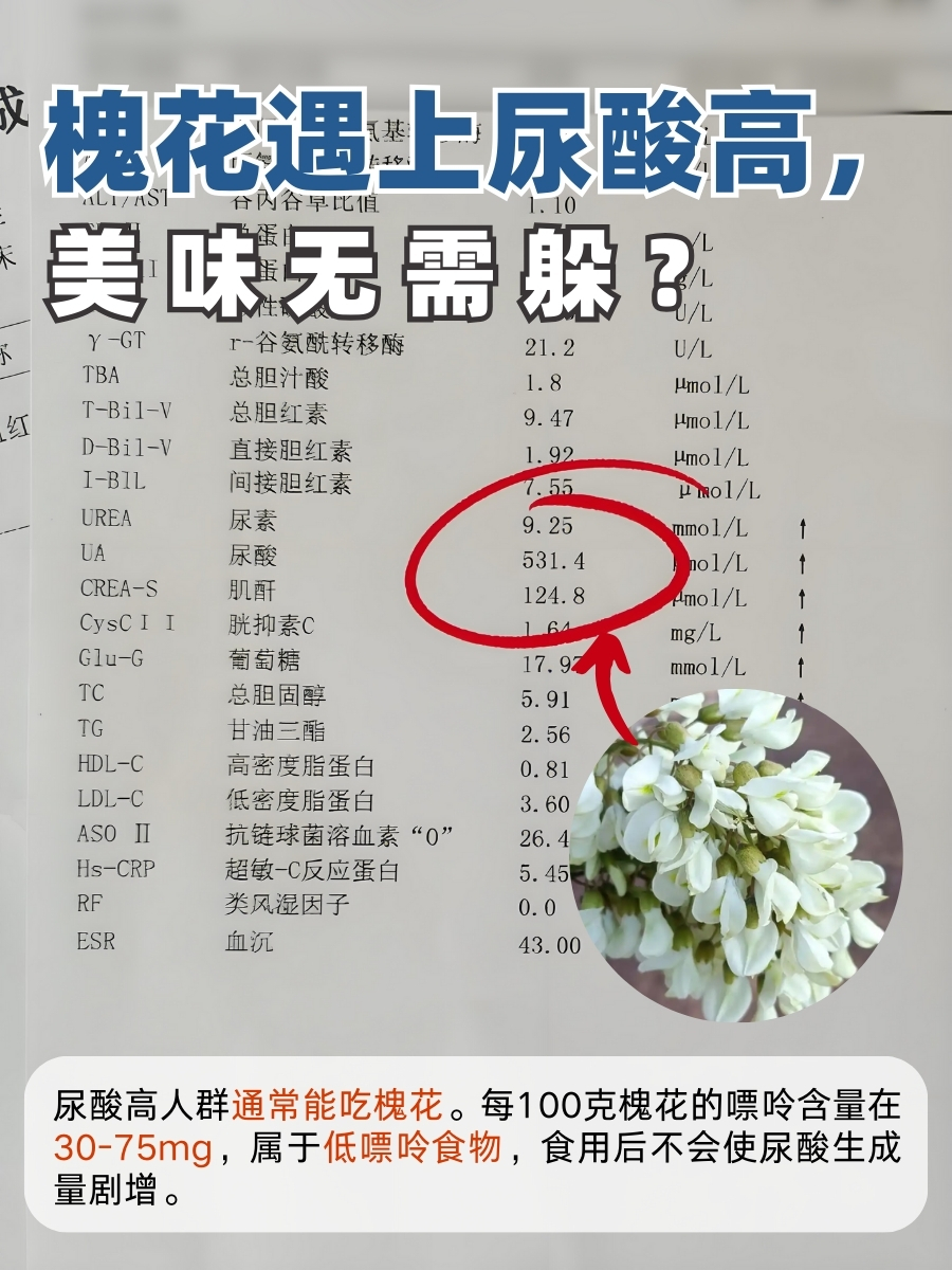 槐花遇上尿酸高，美味无需躲？