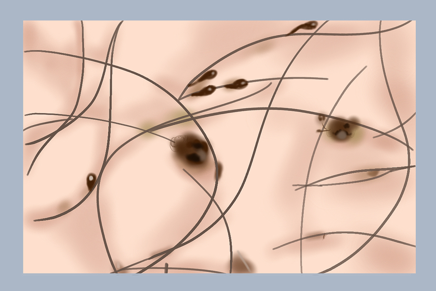 男人阴囊长阴虱图