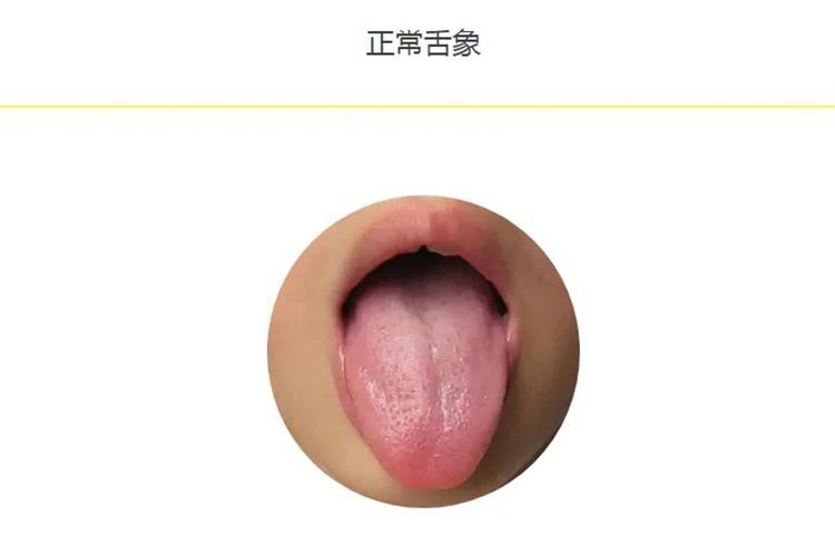 小孩正常舌苔图