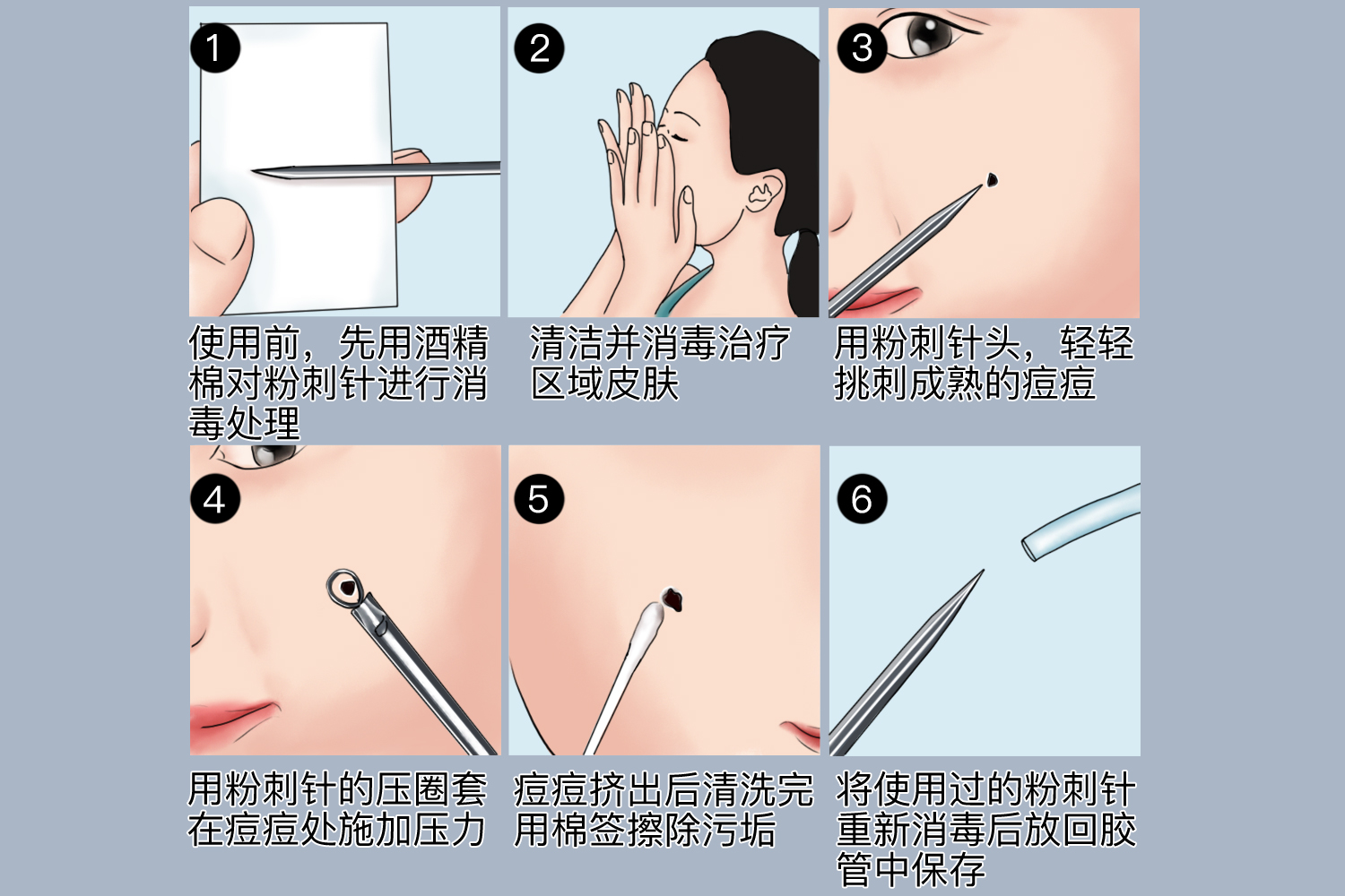 针挑黑头4328图片