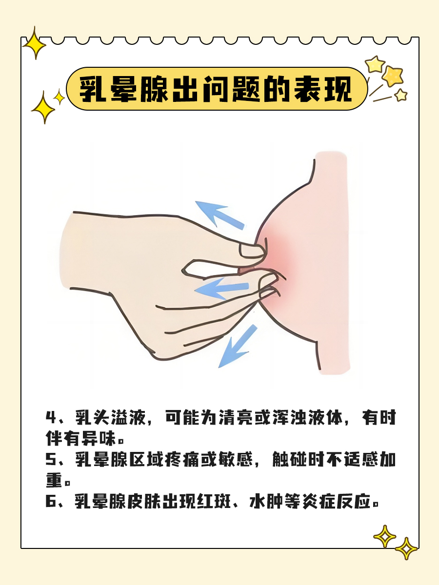 医学链接|乳晕腺是个啥？