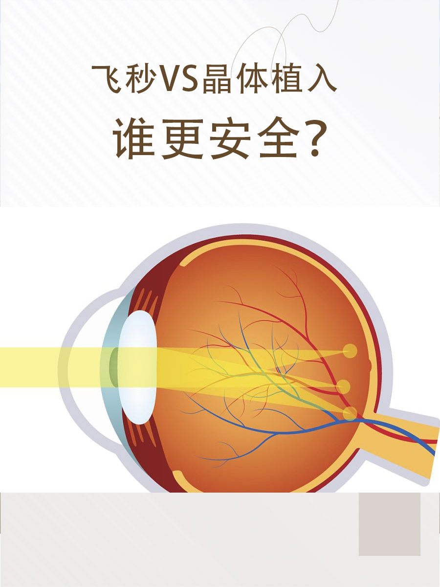 飞秒VS晶体植入，谁更安全？