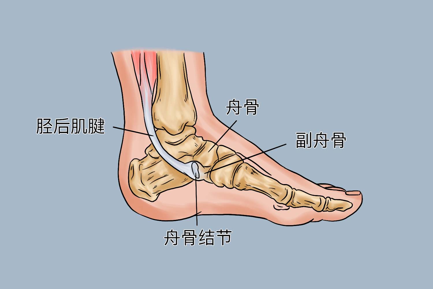 足舟骨结节位置图