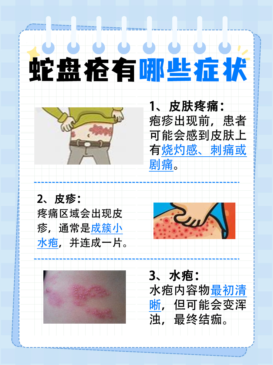 蛇盘疮是否会传染给他人？了解其传播风险