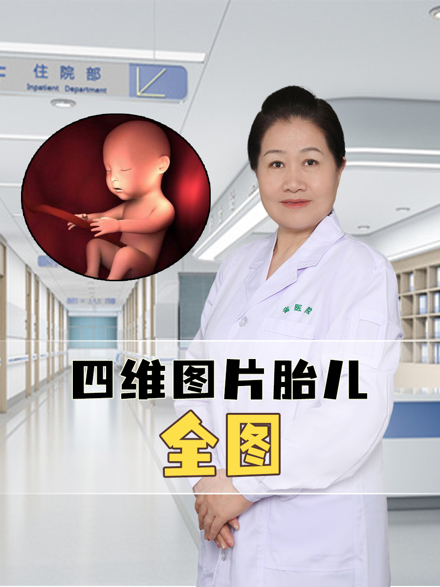 四维图片胎儿全图