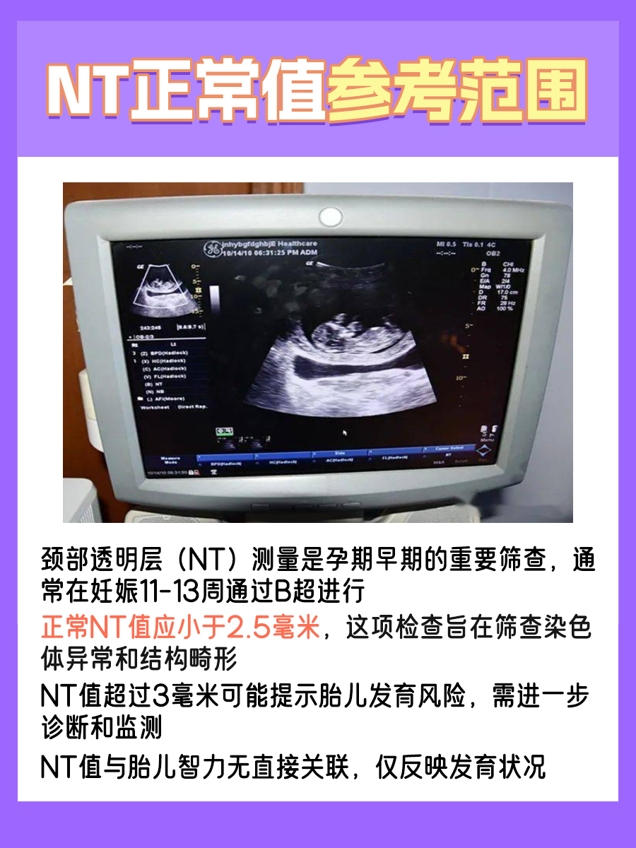 NT值标准范围，孕妇健康指标一览！
