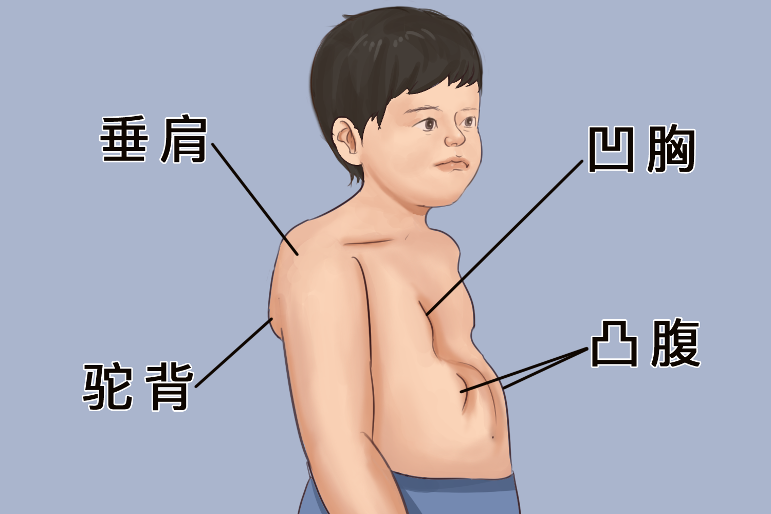 宝宝弓背姿势图片