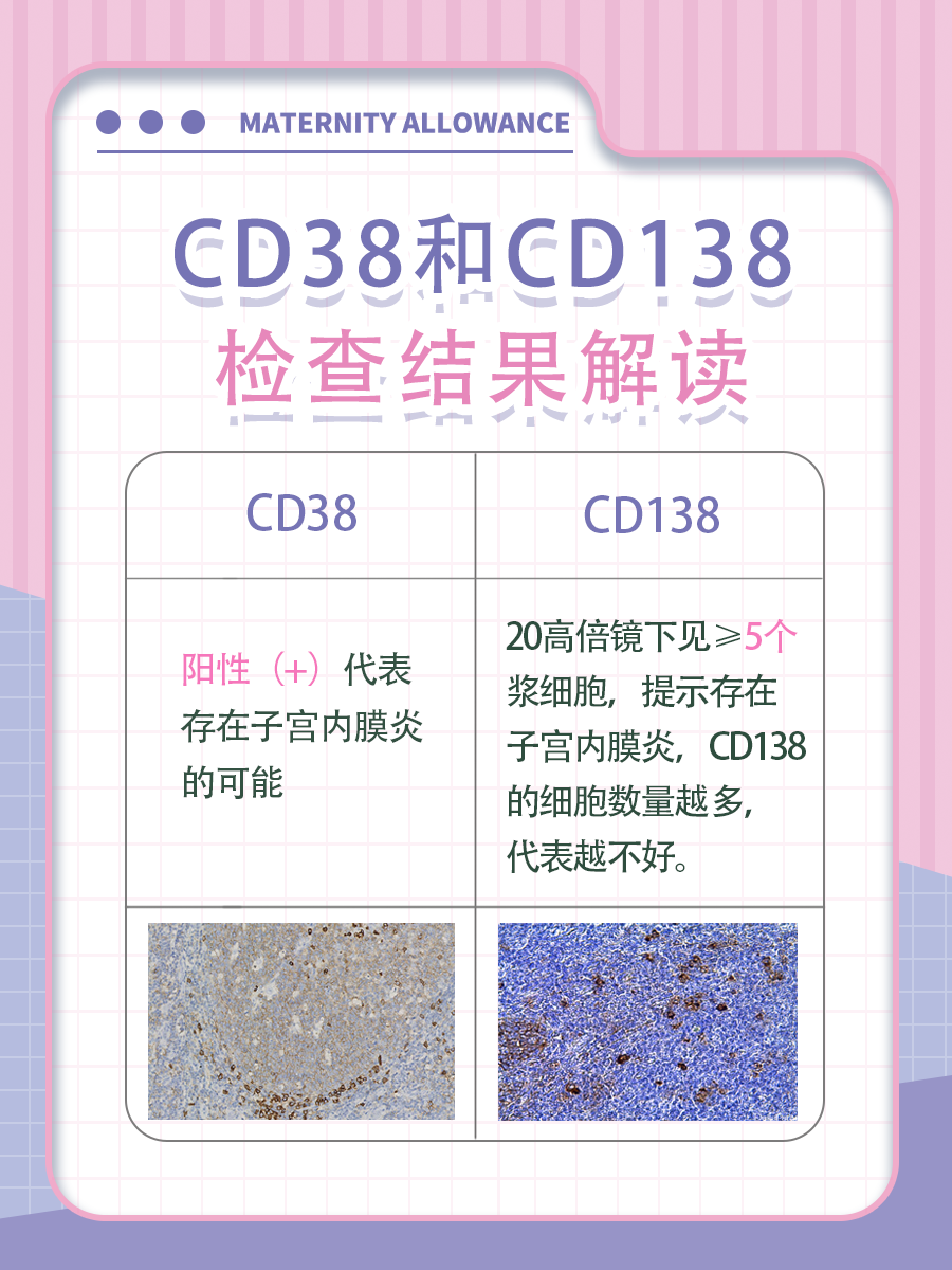 CD38和CD138,医生教你读懂这两个指标