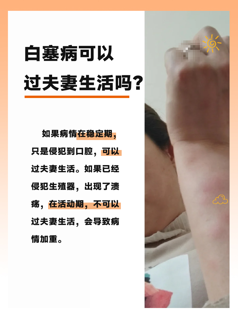 白塞病患者：夫妻生活是否可行