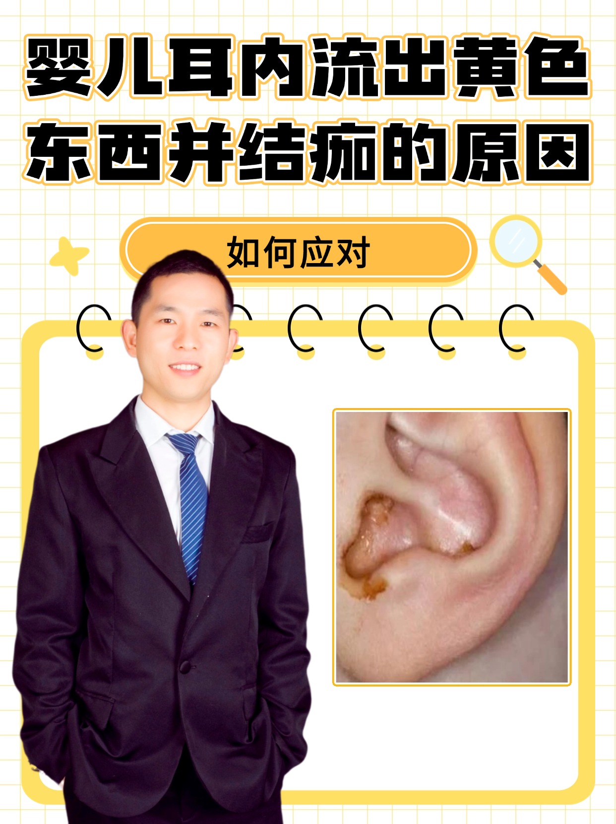 婴儿耳内流出黄色东西并结痂的原因，如何应对