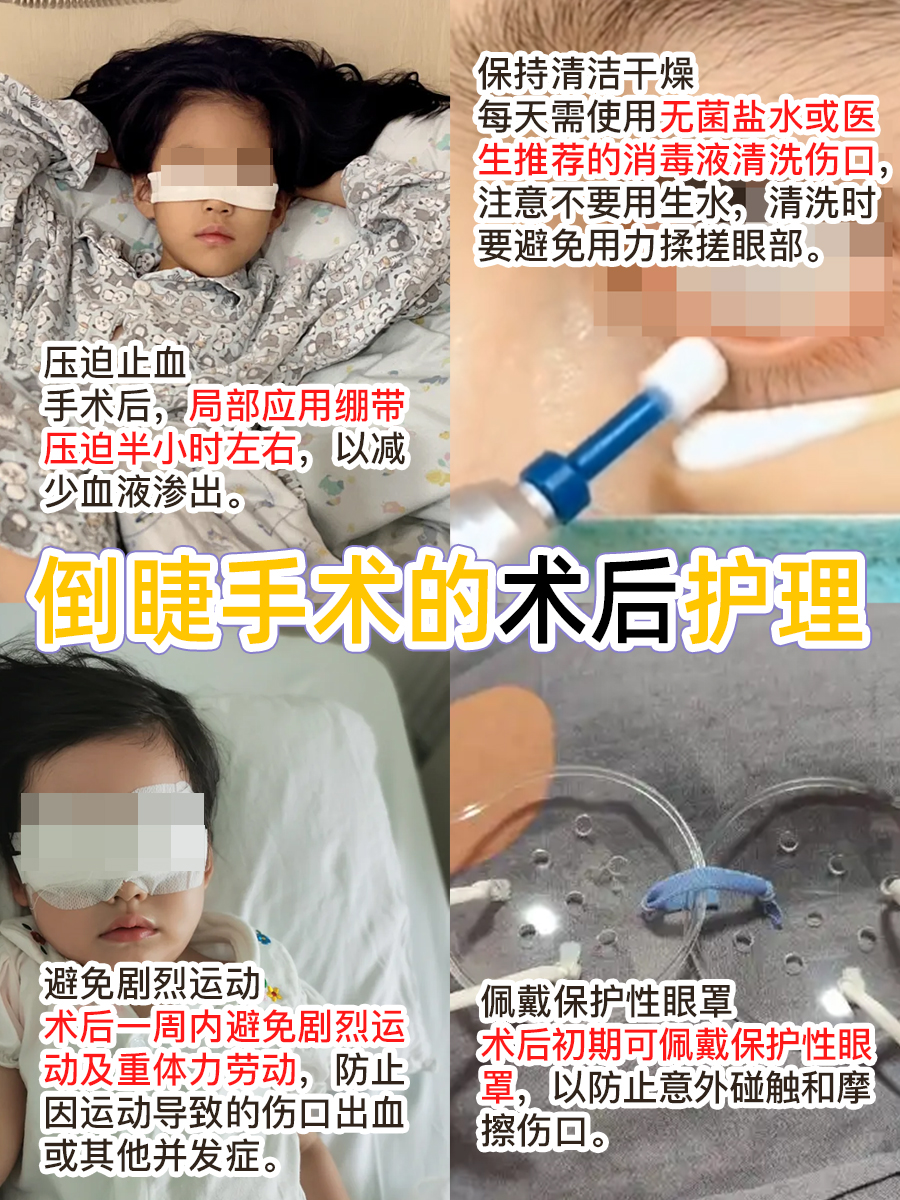 倒睫毛问题,双眼皮手术是更优解吗?