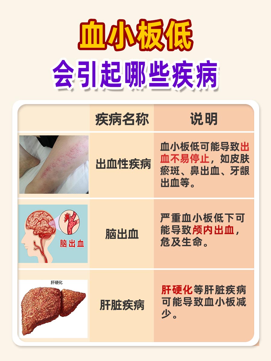血小板低为何不建议输血小板？血液疾病解析