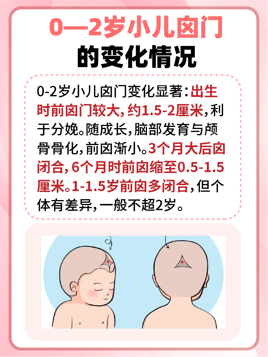 0—2岁小儿囟门对照表？看这篇就够了！
