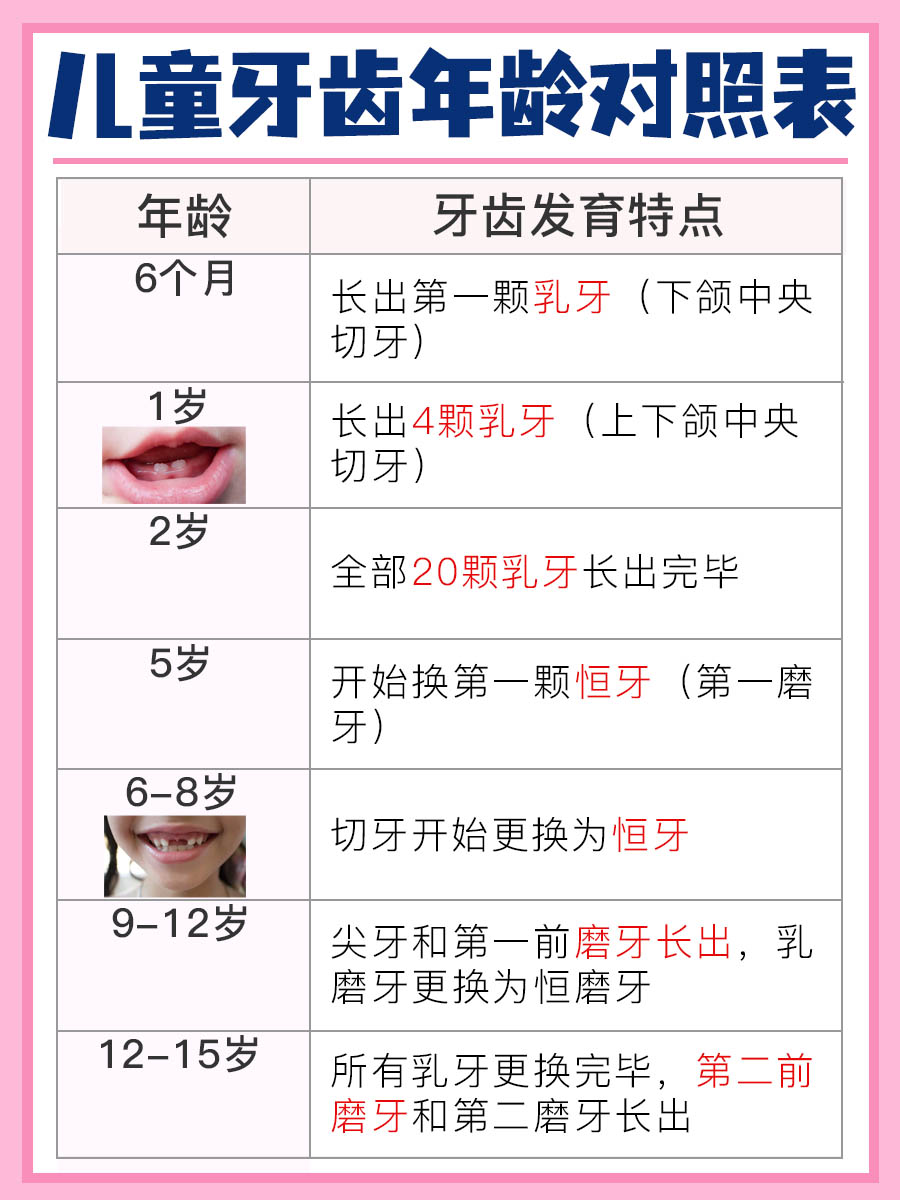 儿童牙齿年龄对照表