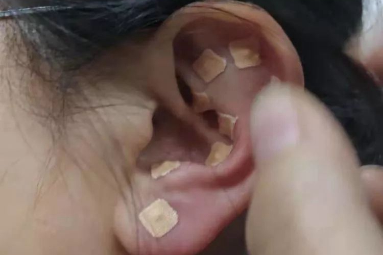 贴耳豆图 贴耳豆图