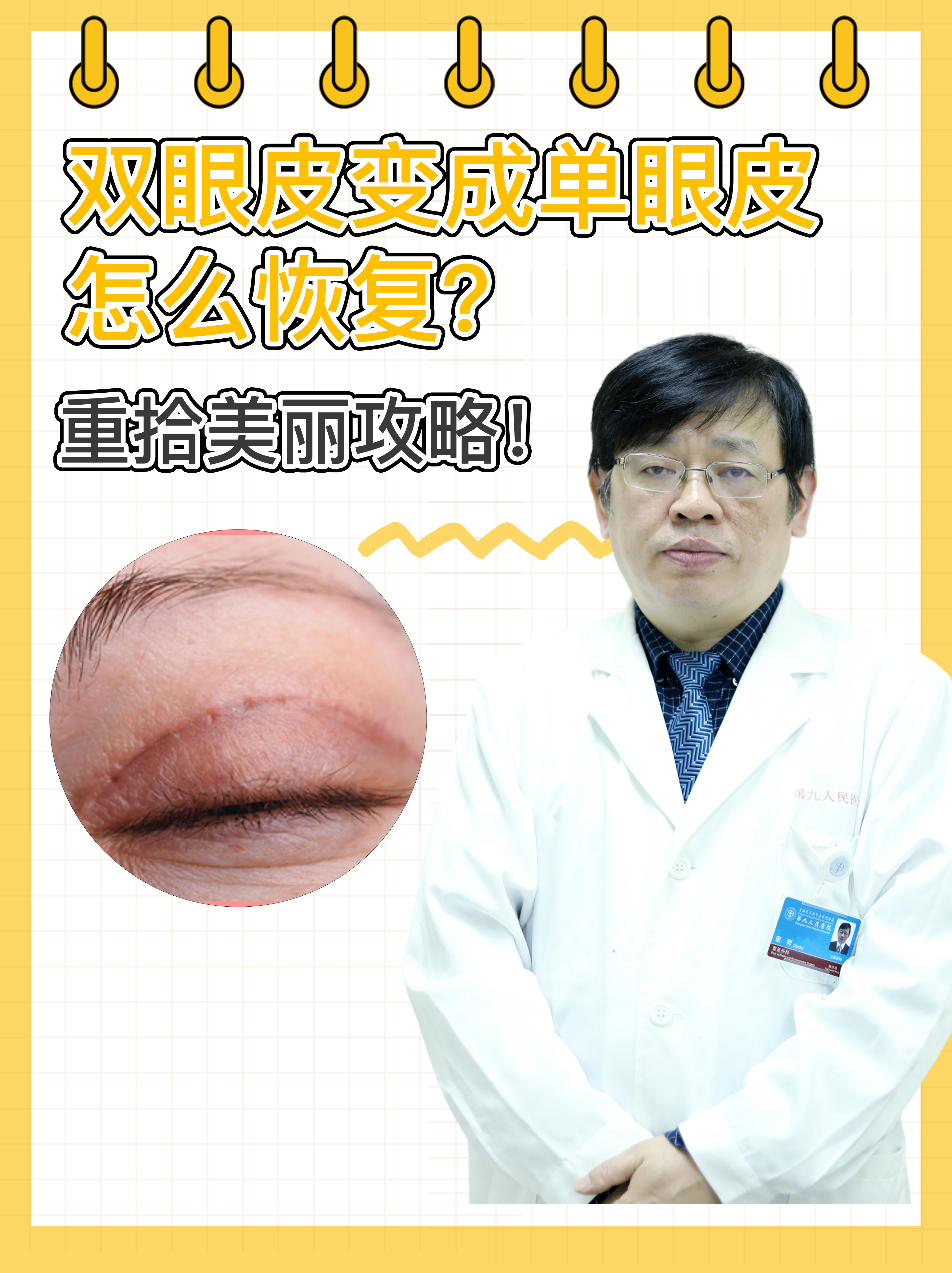 双眼皮变成单眼皮怎么恢复？重拾美丽攻略！