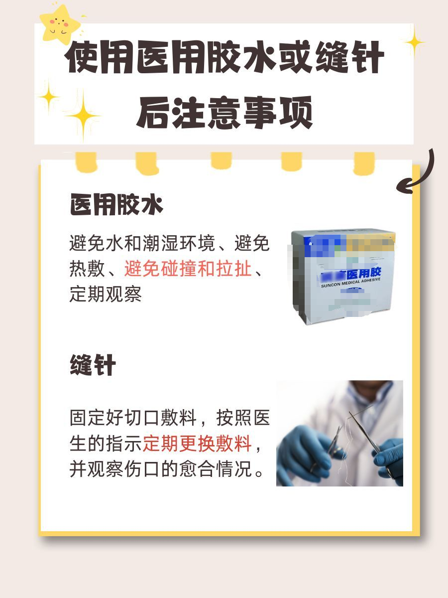 揭秘！医用胶水VS缝针，疤痕大比拼！