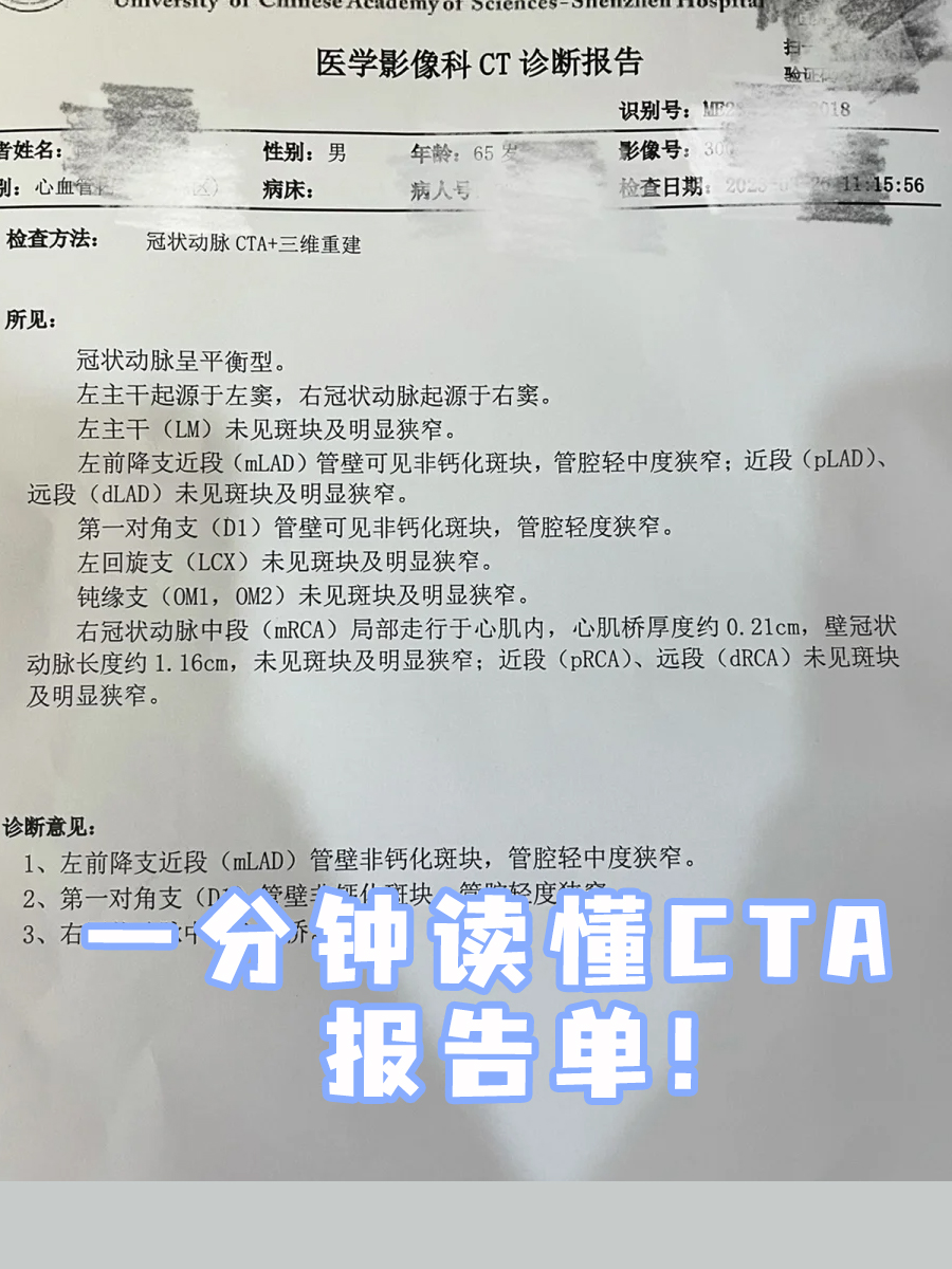 普通人也能看懂！CTA报告单