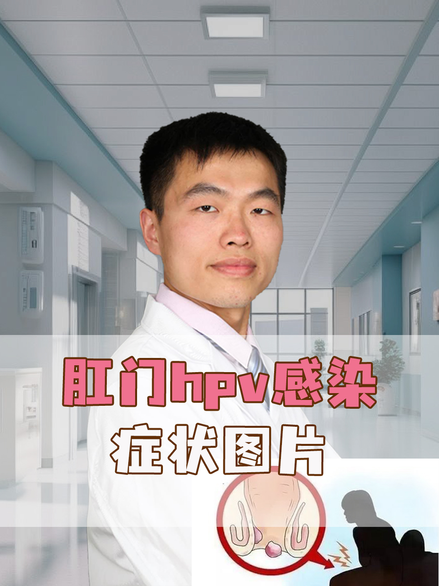 肛门hpv感染症状图片
